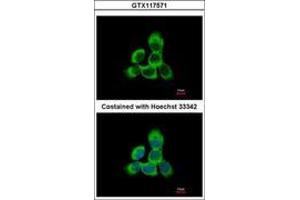Image no. 3 for anti-Cytoglobin (CYGB) (AA 1-190) antibody (ABIN1501883) (CYGB antibody  (AA 1-190))