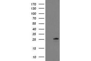 HEK293T cells were transfected with the pCMV6-ENTRY control (Left lane) or pCMV6-ENTRY C1orf50 (Right lane) cDNA for 48 hrs and lysed. (C1ORF50 antibody)