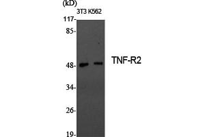 Western Blotting (WB) image for anti-Tumor Necrosis Factor Receptor Superfamily, Member 1B (TNFRSF1B) antibody (ABIN5957804) (TNFRSF1B antibody)