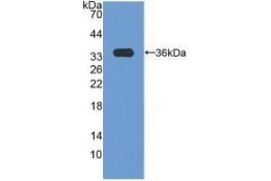 Detection of Recombinant CCND3, Human using Polyclonal Antibody to Cyclin D3 (CCND3) (Cyclin D3 antibody  (AA 1-292))