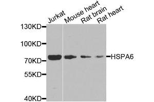 Western blot analysis of extracts of various cell lines, using HSPA6 antibody. (HSPA6 antibody  (AA 474-643))