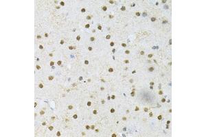 Immunohistochemistry of paraffin-embedded mouse brain using SNRPE Antibody (ABIN1876676) at dilution of 1:200 (40x lens). (SNRPE antibody)