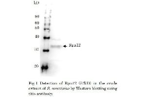 Western Blotting (WB) image for anti-Proteasome (Prosome, Macropain) 26S Subunit, Non-ATPase, 8 (PSMD8) antibody (ABIN2452112) (PSMD8 antibody)