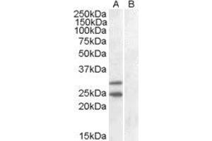HEK293 overexpressing SOCS1 and probed with ABIN2560058 (mock transfection in lane B). (SOCS1 antibody  (C-Term))