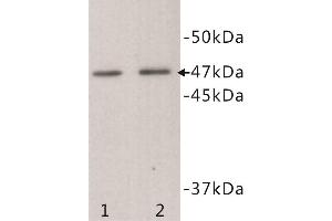 Western Blotting (WB) image for anti-Transmembrane Protein 200A (TMEM200A) antibody (ABIN1854992) (TMEM200A antibody)