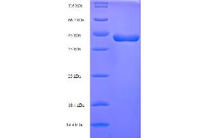p40 (p63 Delta) (AA 1-354), (full length) protein (His tag)