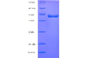 SDS-PAGE (SDS) image for p40 (p63 Delta) (AA 1-354), (full length) protein (His tag) (ABIN4975047) (p40 (p63 Delta) (AA 1-354), (full length) protein (His tag))