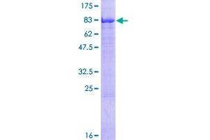 Image no. 1 for Gigaxonin (GAN) (AA 1-597) protein (GST tag) (ABIN1354773) (GAN Protein (AA 1-597) (GST tag))