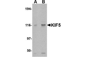 Image no. 1 for anti-Kinesin Family Member 5A (KIF5A) (C-Term) antibody (ABIN203723) (KIF5A antibody  (C-Term))