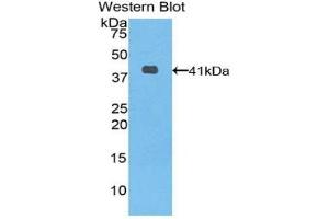 Western blot analysis of the recombinant protein. (KRT6A antibody  (AA 163-468))