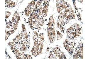 ITGB1BP2 antibody was used for immunohistochemistry at a concentration of 4-8 ug/ml to stain Skeletal muscle cells (arrows) in Human Muscle. (ITGB1BP2 antibody)