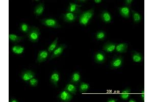 Immunofluorescence of monoclonal antibody to NR1D2 on HeLa cell. (NR1D2 antibody  (AA 1-579))