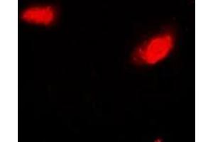 Immunofluorescent analysis of SIRT7 staining in Hela cells. (SIRT7 antibody)