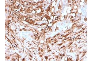Immunohistochemistry (IHC) image for anti-Ferritin, Light Polypeptide (FTL) (AA 38-165) antibody (ABIN6939462)