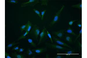 Immunofluorescence of purified MaxPab antibody to SETBP1 on HeLa cell. (SETBP1 antibody  (AA 1-242))
