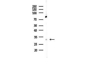 Western blot analysis of lysates from 293 cells(UV,30 min treatment), using Calretinin Antibody at 1/1000 dilution.