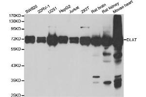 Western blot analysis of extracts of various cell lines, using DLAT antibody. (DLAT antibody)