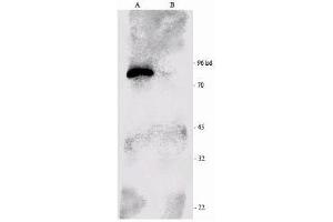 Western-blot analysis of p90 RSK1 immunoprecipitated from the mouse brain extract (B) and using RSK1-HRP as a probe. (RPS6KA1 antibody  (C-Term))