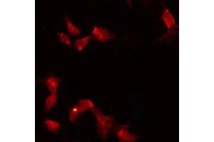 ABIN6272321 staining HeLa by IF/ICC. (HORMAD1 antibody  (C-Term))