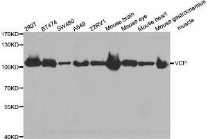 Western blot analysis of extracts of various cell lines, using VCP antibody (ABIN5971478) at 1:300 dilution. (VCP antibody)