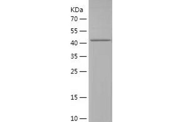 UBA5 Protein (AA 197-404) (His-IF2DI Tag)