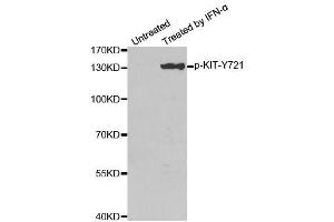 Western blot analysis of extracts from HeLa cells, using Phospho-KIT-Y721 antibody (ABIN2988115). (KIT antibody  (pTyr721))