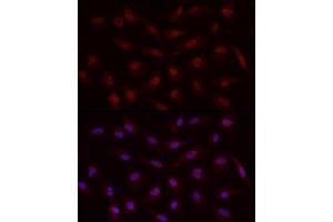 Immunofluorescence analysis of A-549 cells using Smad7 Rabbit pAb (ABIN6133913, ABIN6148093, ABIN6148095 and ABIN6215945) at dilution of 1:50 (40x lens). (SMAD7 antibody  (AA 1-100))