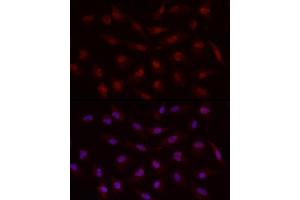 Immunofluorescence analysis of A-549 cells using Smad7 Rabbit pAb (ABIN6133913, ABIN6148093, ABIN6148095 and ABIN6215945) at dilution of 1:50 (40x lens). (SMAD7 antibody  (AA 1-100))