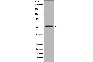 Western blot analysis of Smad2 expression in Jurkat cell lysate. (Recombinant SMAD2 antibody)