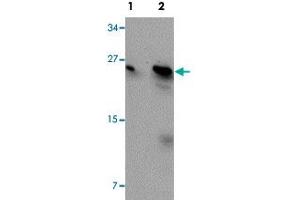 Western blot analysis of MCF-7 cells with BCAS2 polyclonal antibody  at (Lane 1) 0. (BCAS2 antibody  (C-Term))