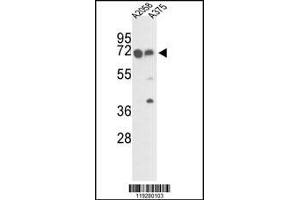 Western blot analysis of FKBP10 Antibody in A2058 and A375 cell line lysates (35ug/lane) (FKBP10 antibody  (C-Term))