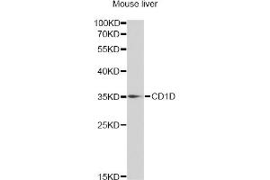 Western blot analysis of extracts of mouse liver, using CD1D antibody (ABIN6292676) at 1:1000 dilution.