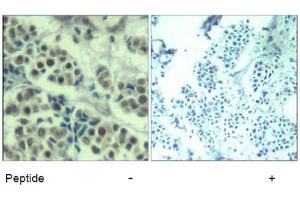 Image no. 3 for anti-Mdm2, p53 E3 Ubiquitin Protein Ligase Homolog (Mouse) (MDM2) (Ser166) antibody (ABIN319418) (MDM2 antibody  (Ser166))