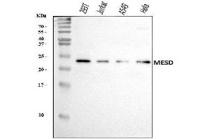 Western blot analysis of MESDC2/MESD using anti-MESDC2/MESD antibody (ABIN7602508).