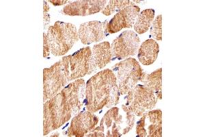 Immunohistochemical analysis of paraffin-embedded H. (COX6A2 antibody  (AA 37-66))