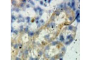Used in DAB staining on fromalin fixed paraffin-embedded Kidney tissue (BCL2L1 antibody  (AA 2-212))