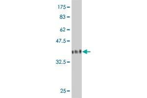 Western Blot detection against Immunogen (36. (GMPPA antibody  (AA 321-420))