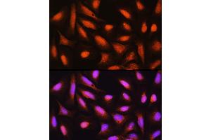 Immunofluorescence analysis of U-2 OS cells using GMFB Rabbit pAb (ABIN6131732, ABIN6141181, ABIN6141182 and ABIN6224741) at dilution of 1:100 (40x lens). (GMFB antibody  (AA 1-140))