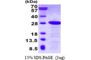 Dysbindin (Dystrobrevin Binding Protein 1) Domain Containing 2 (DBNDD2) (AA 1-161) protein (His tag)