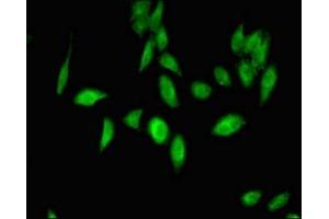Immunofluorescent analysis of Hela cells using ABIN7174571 at dilution of 1:100 and Alexa Fluor 488-congugated AffiniPure Goat Anti-Rabbit IgG(H+L) (ube3a antibody  (AA 83-234))