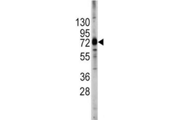 ABCG2 anticorps  (AA 305-335)