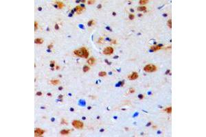 Immunohistochemical analysis of Topoisomerase 3 beta1 staining in human brain formalin fixed paraffin embedded tissue section. (Topoisomerase 3 Beta1 (N-Term) antibody)