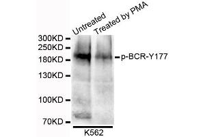 Western blot analysis of extracts of K562 cells, using Phospho-BCR-Y177 antibody. (BCR antibody  (pTyr177))