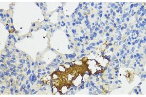 Immunohistochemistry of paraffin-embedded Mouse lung using Complement Factor B Polyclonal Antibody at dilution of 1:200 (40x lens). (Complement Factor B antibody)