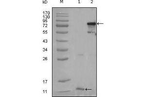 Western Blot showing PPARG antibody used against truncated PPARG-His recombinant protein (1) and full-length PPARG (aa1-477) transfected CHO-K1 cell lysate (2).