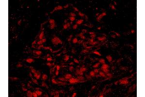 Immunofluorescence (IF) image for anti-Breast Cancer 1 (BRCA1) (AA 700-750) antibody (ABIN7448934) (BRCA1 antibody  (AA 700-750))