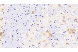 Detection of GAB2 in Mouse Cerebrum Tissue using Polyclonal Antibody to GRB2 Associated Binding Protein 2 (GAB2) (GAB2 antibody  (AA 357-607))