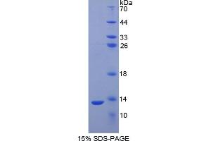 SDS-PAGE (SDS) image for S100 Calcium Binding Protein A2 (S100A2) ELISA Kit (ABIN6720486)