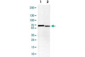 Western Blot analysis of Lane 1: NIH-3T3 cell lysate (mouse embryonic fibroblast cells) and Lane 2: NBT-II cell lysate (Wistar rat bladder tumour cells) with STK3 polyclonal antibody . (STK3 antibody)