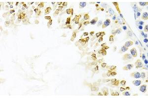 Immunohistochemistry of paraffin-embedded Mouse testis using GEMIN2 Polyclonal Antibody at dilution of 1:100 (40x lens). (SIP1 antibody)